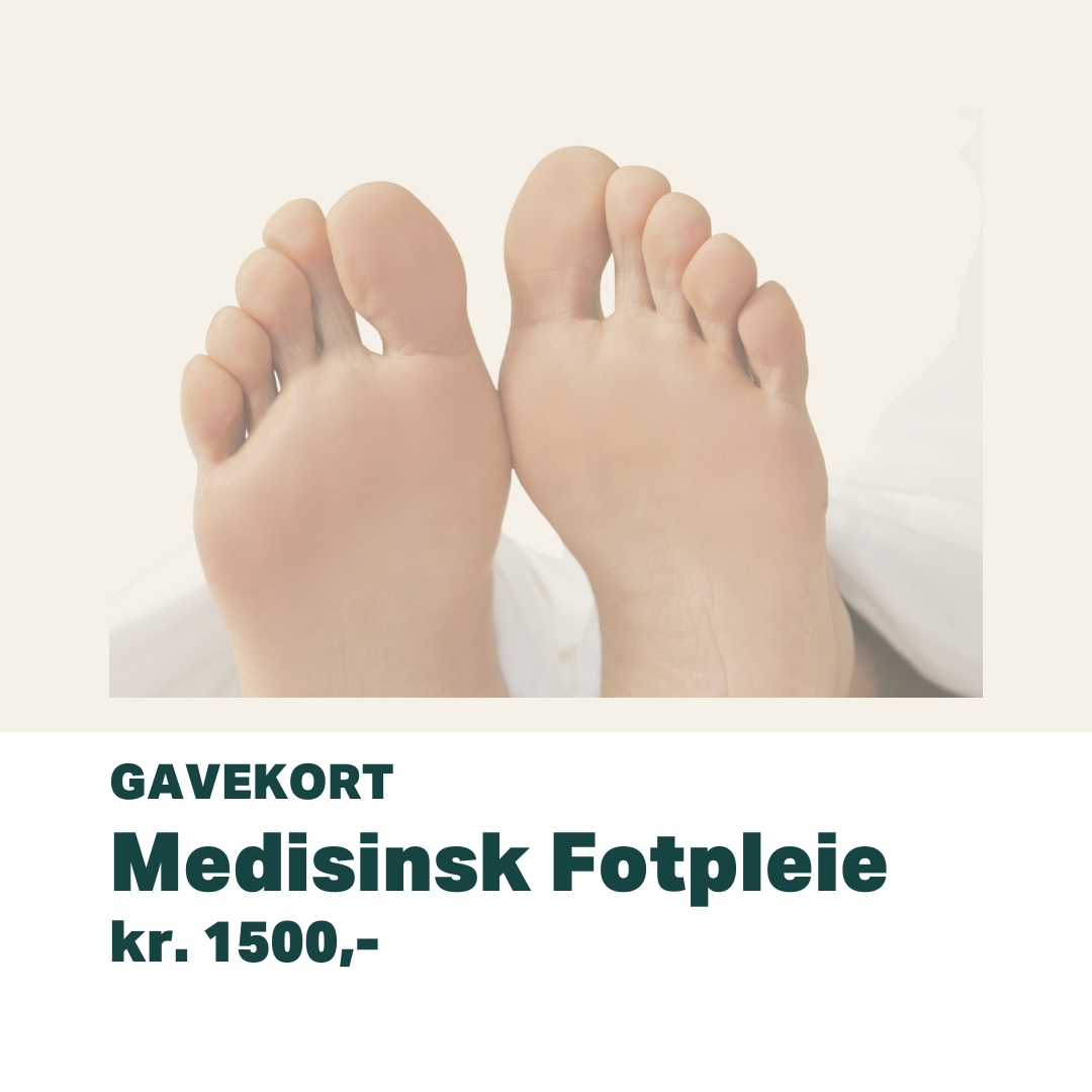 Gavekort Medisinsk Fotpleie | Oslo Hudpleieklinikk Medispa Nærbilde av føtter før medisinsk fotpleiebehandling hos Oslo Hudpleieklinikk Medispa.